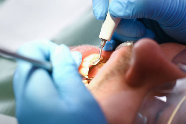 Best Pediatric Emergency Dentist in Brandywine, MD