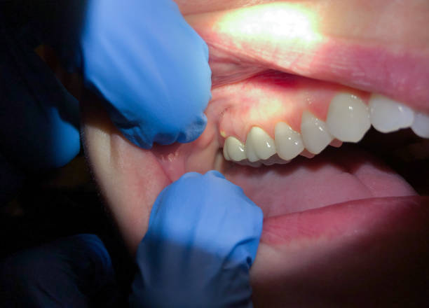 Best Urgent Dental Care for Toothache in Brandywine, MD